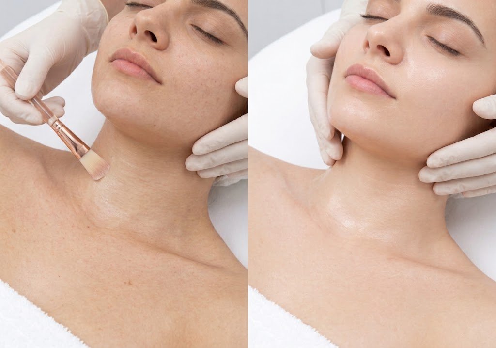 Before and after skin brightening